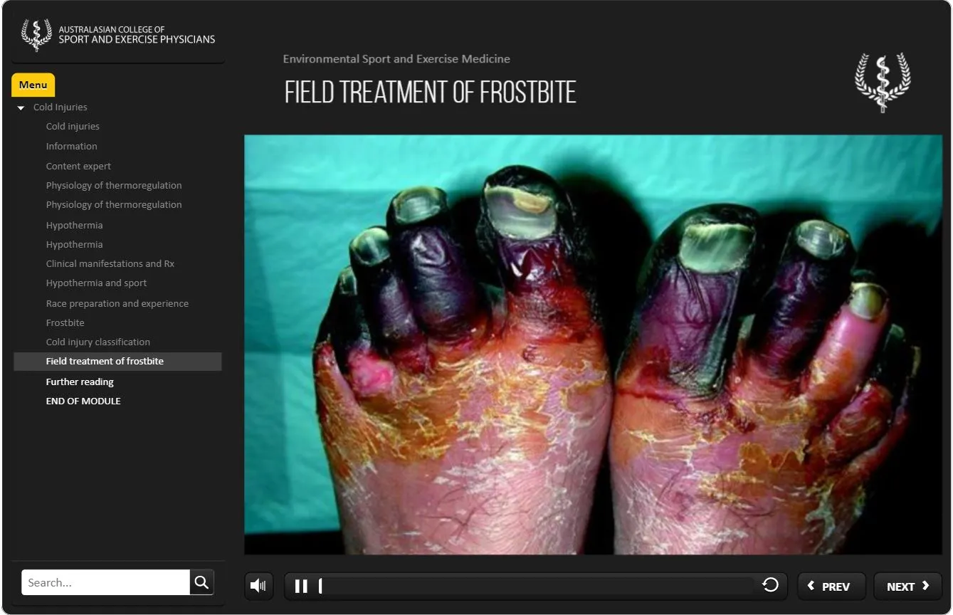 Cold Injuries & Illness